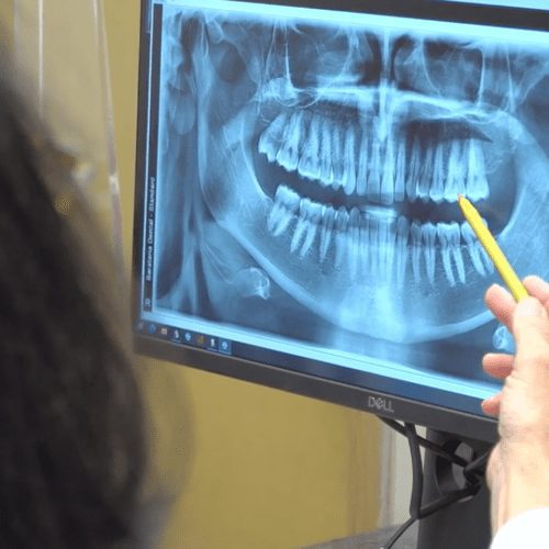 Restorative Dentistry