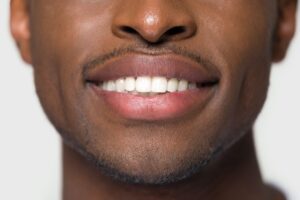 4 Ways to a Whiter Smile