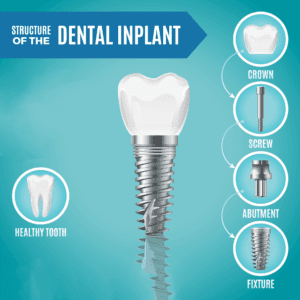 A dental implant provides a durable, natural-looking replacement that could improve both oral health and self-esteem.